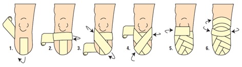 بانداژ استمپ زیر زانو،زیر آرنج و بالای آرنجBelow knee , Below Elbow & Above elbow Bandaging   